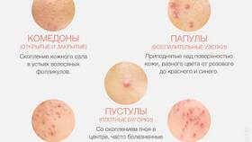 Что включает в себя подписка: содержание и особенности в Магия Золота