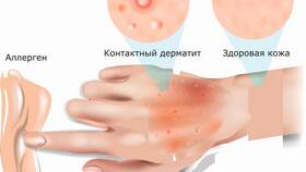 Как устранить красное пятно на коже